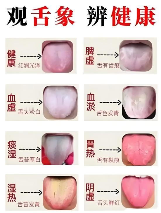 【免费舌诊】你发舌头照片，我来辨证分析！

不玩套路，现场出结果！

拍摄时要注