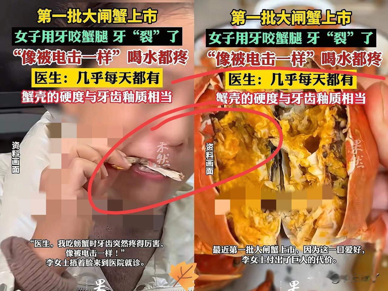 “悲剧还是发生了！”近日，浙江杭州，一女子在家吃螃蟹，她用牙齿咬开螃蟹腿时，突然