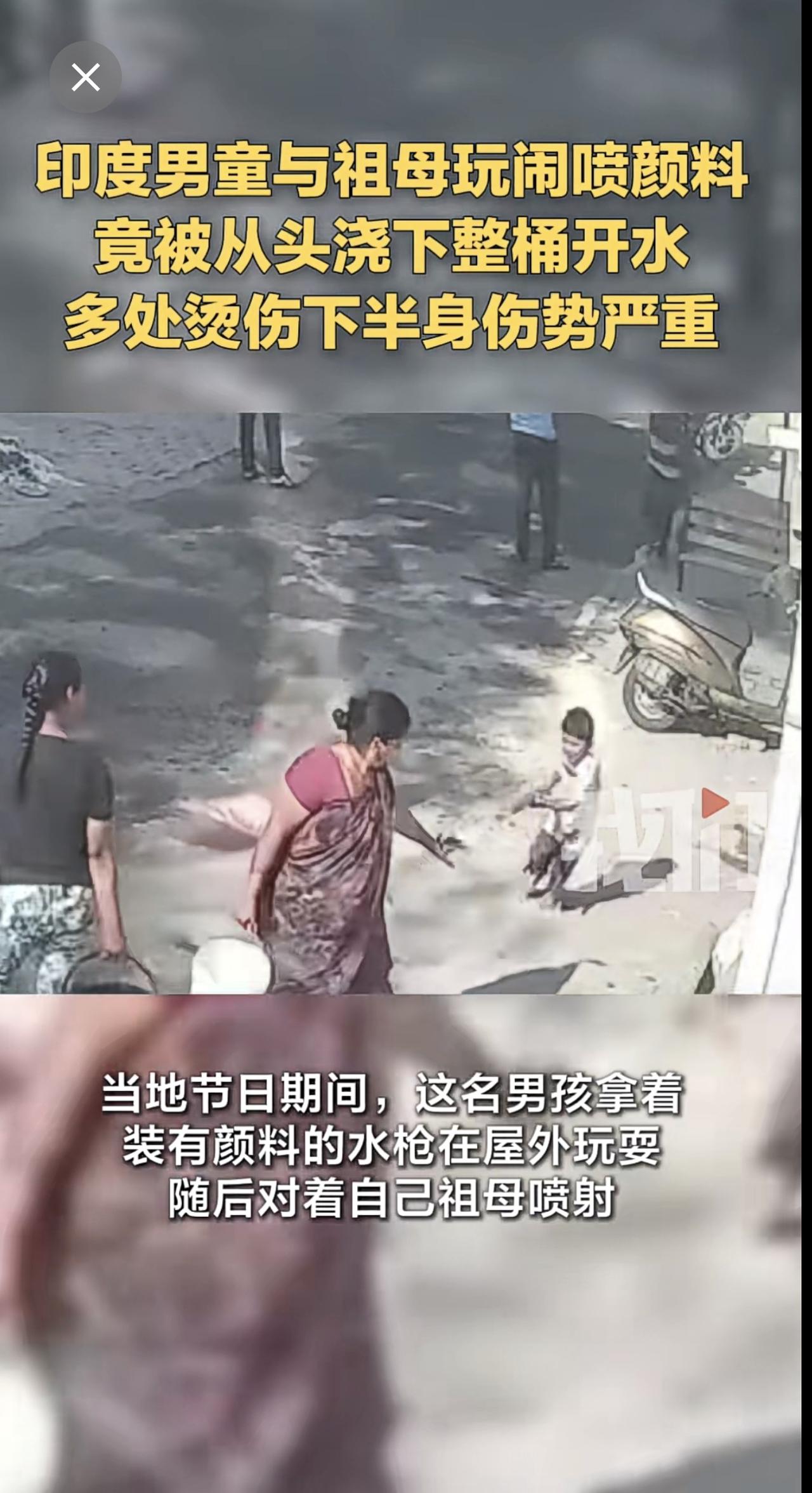 印度男童与祖母玩闹喷颜料竟被从头浇下整桶开水 多处烫伤下半身伤势严重
