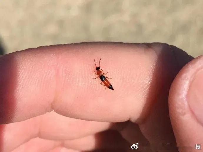 #一句话科普#当隐翅虫停留在你的皮肤上时，最佳的解决方式是：弹走。（千万别拍打它