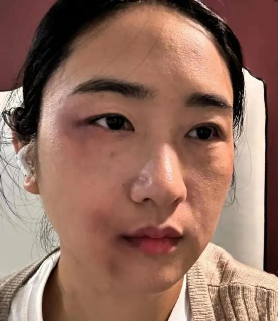 [微风]孕36周的准妈妈被丈夫一脚踹在腰侧，没哭没闹，转头去医院开了病历直奔派出