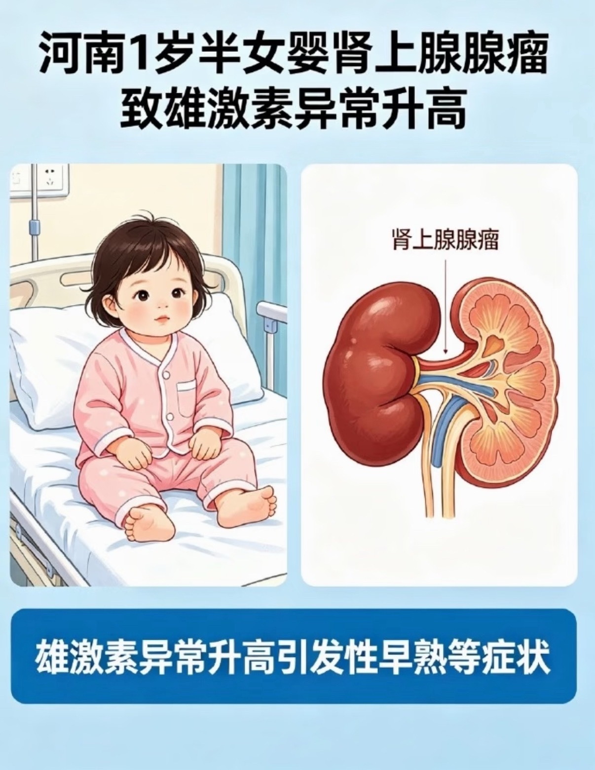 1岁半女婴私处发育异常险变男孩1岁半女婴私处发育异常险变男孩，这类肿瘤在1-18