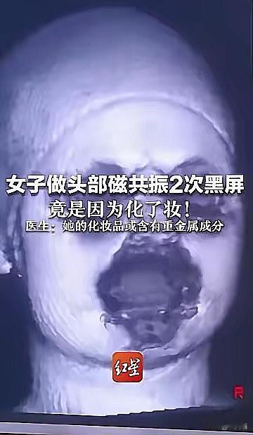 谁能想到！
化个日常妆去做核磁共振，
居然让仪器两次黑屏罢工？杭州这位女士的遭遇