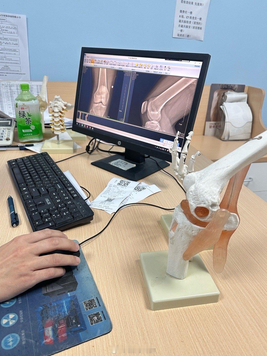 [卡皮巴拉]梅开二度绊倒 磕同一个膝盖人生小体验 解锁骨科（一次就行千万别再来了