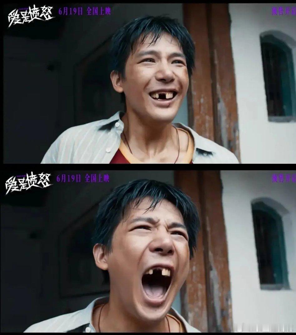 我嘞个破碎哥，安宇哥没牙了 