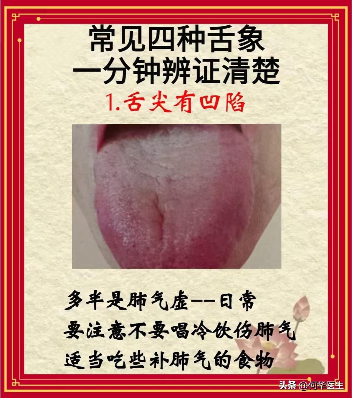 今天周四值班中，有空给大家看舌象！全程不收费！一个不漏，1分钟告知病因和调理方向