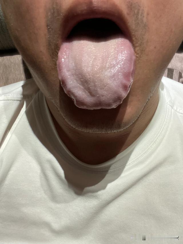 听我一句劝吧大哥，凉的一口都别再吃了，管好你的嘴[狗头][狗头][狗头]
你再整