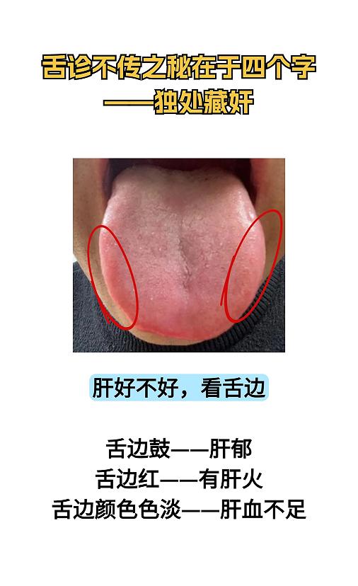 舌诊不传之秘，在于 “ 独处藏奸 ” 这四个字

“独处藏奸”其实就是，从细小之