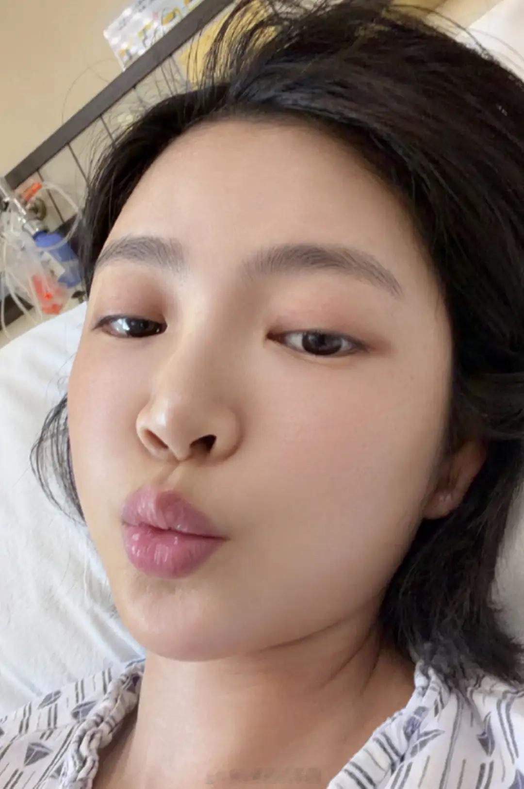 杜淳老婆否认因肿瘤切肺，公开病情是因为肺部感染，术后状态良好！ 