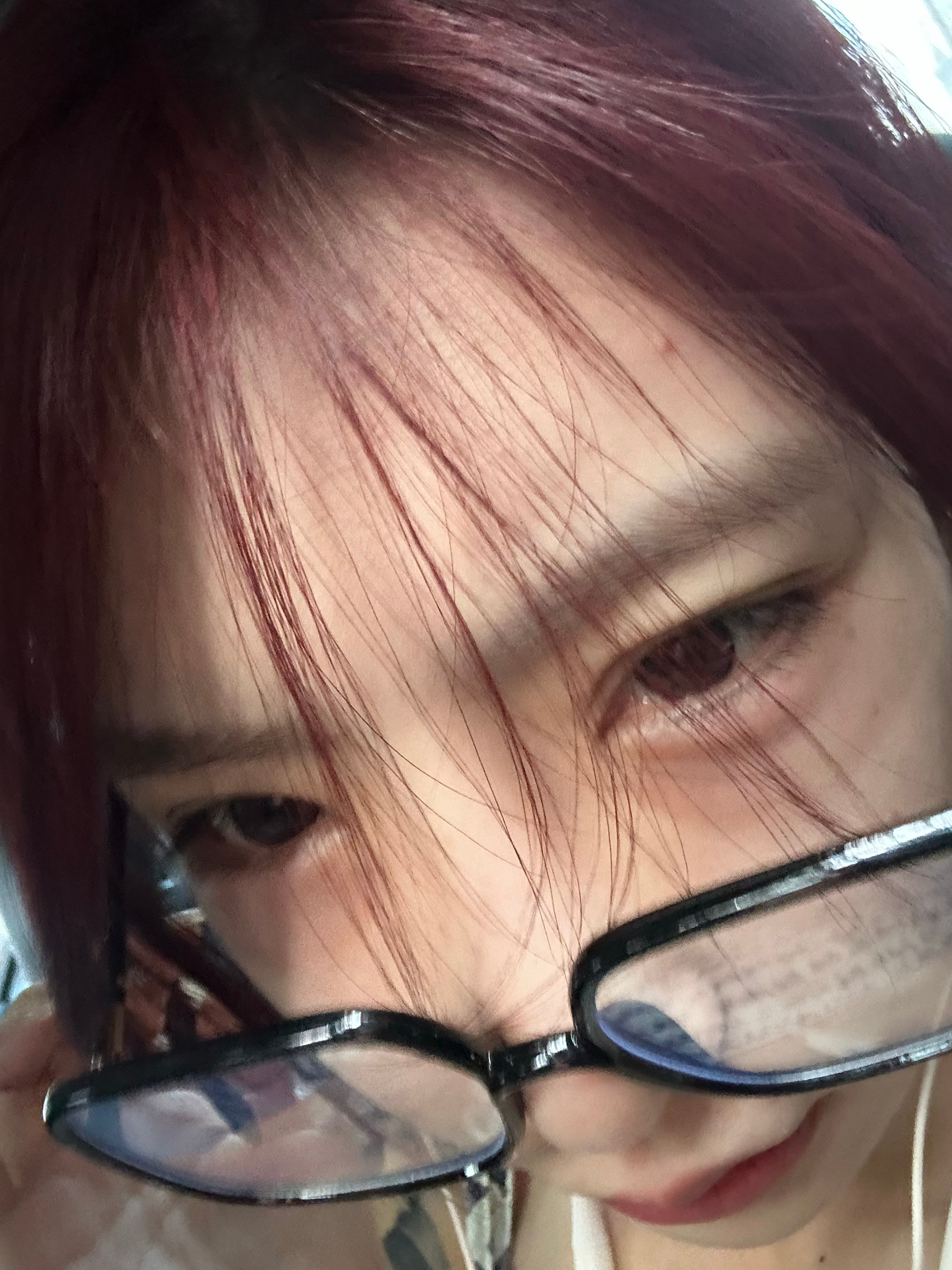 姐妹们 终于融卧蚕了 像被打出来的红色大眼袋 ​​​