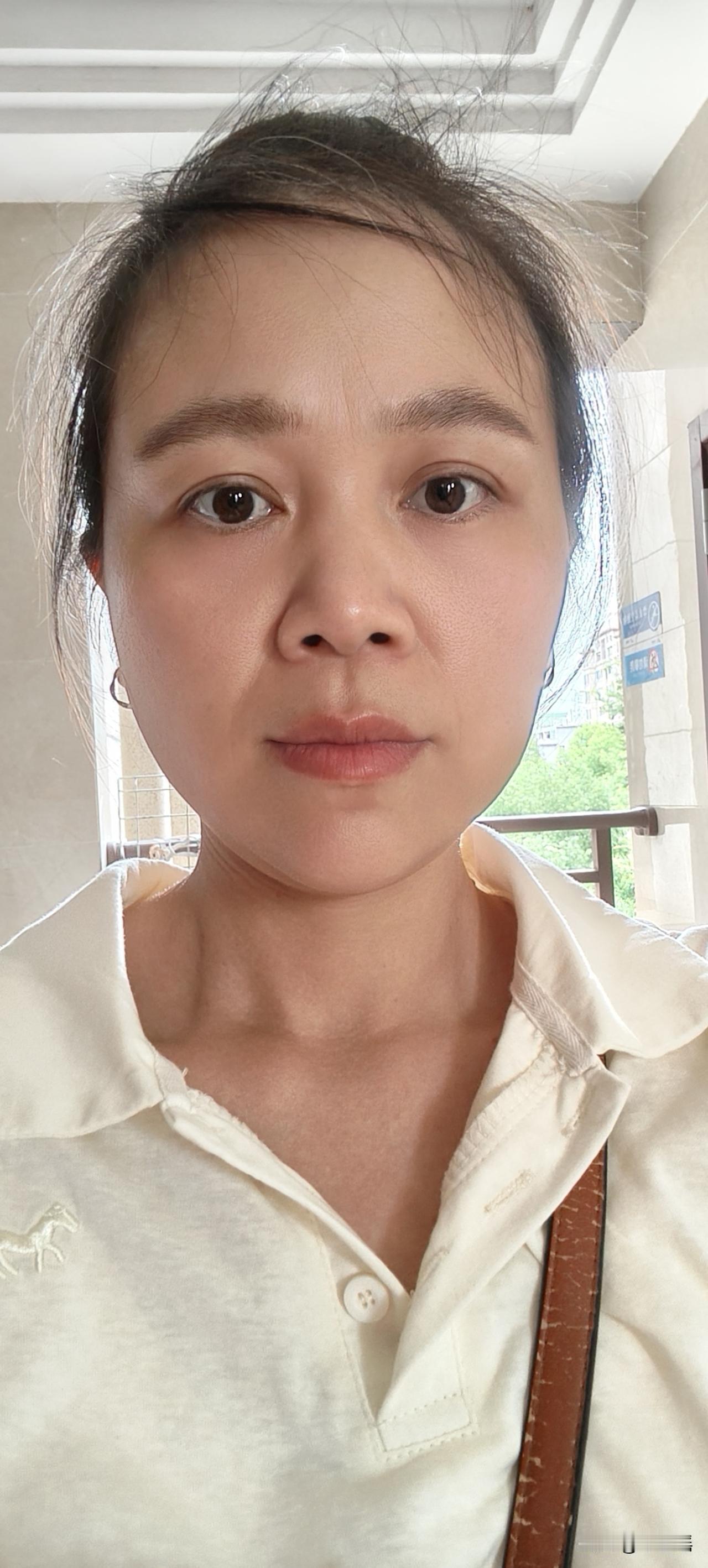时间1分1秒地过去，不知不觉宫颈癌康复就两年了，如果不说，你们能看出我是个康复才