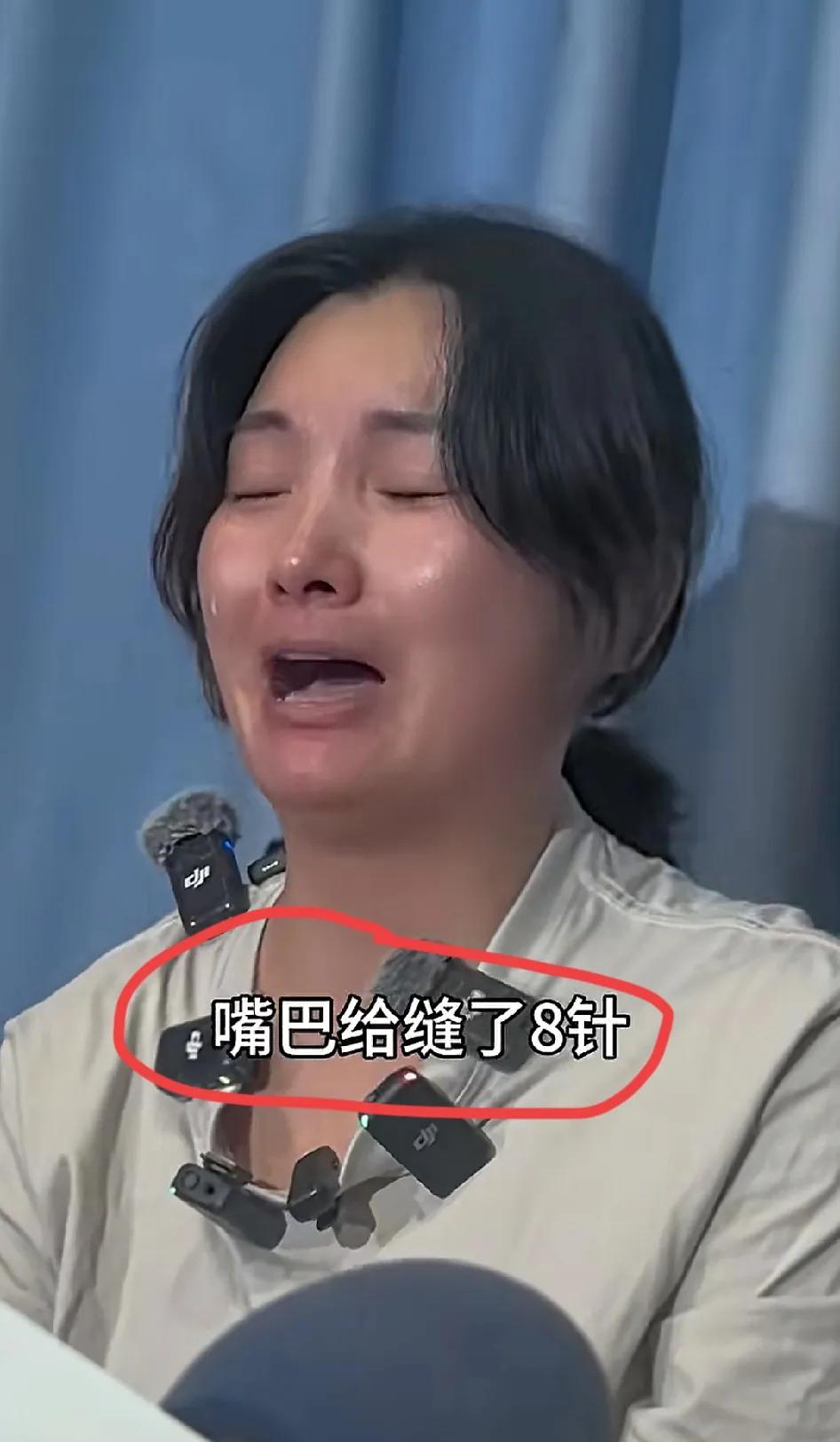 舌头被扎、嘴巴缝针
每天吞20片泻药
脚还被刀划开，这些本该出现在恐怖片里的情节