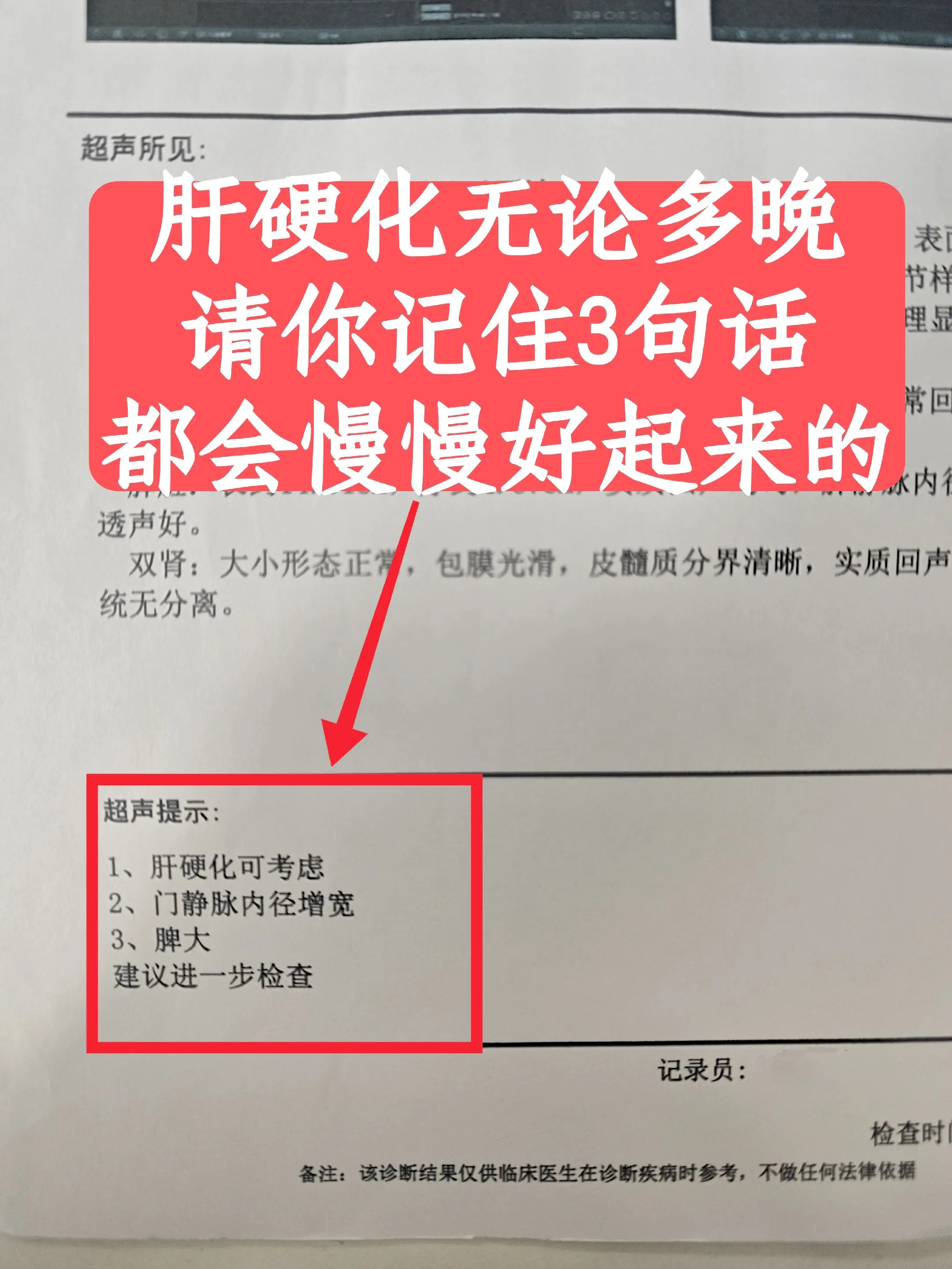 大家好，我是肝病科张峰，门诊遇到的这位患者，刚查出肝硬化就已经是晚期...