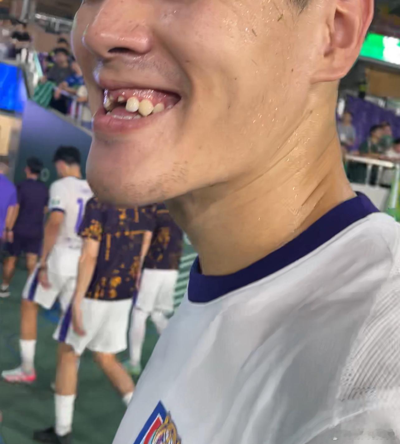 [苦涩] ​​​
