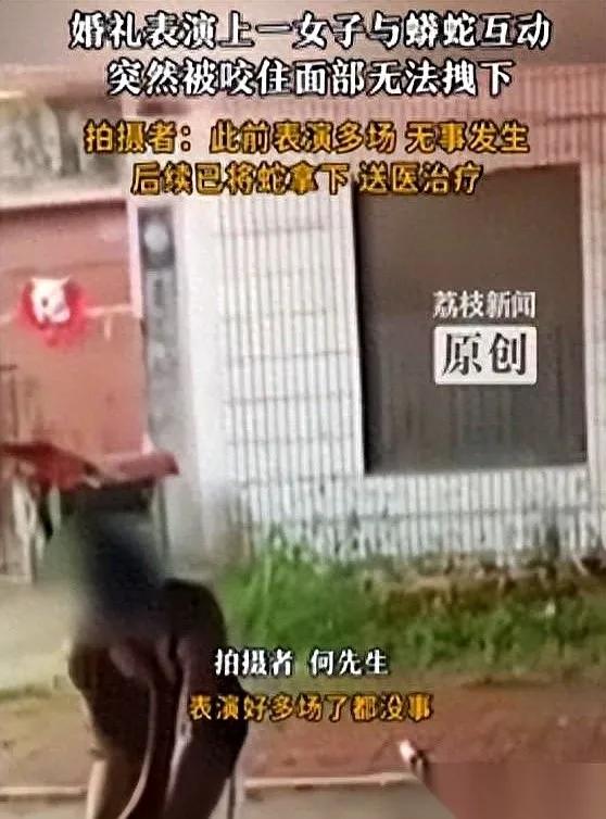 婚礼上发生惊魂一幕：一位表演者被蛇咬，满脸是血，差点让这场婚礼变成丧事！
这心里