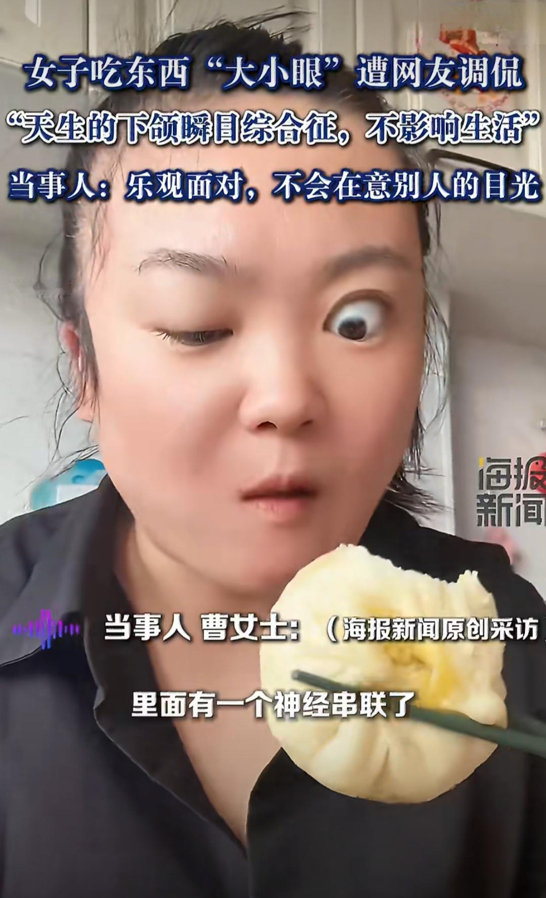 黑龙江鸡西的曹女士，天生嘴巴和眼睛的神经是串联的，所以一吃东西就会出现“大小眼”