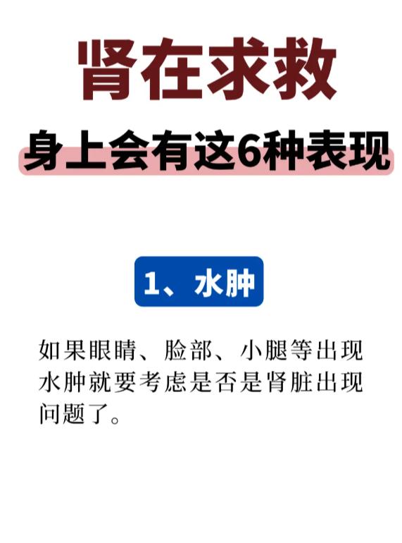 身体若有这 6 种表现，可能是肾脏需要呵护了