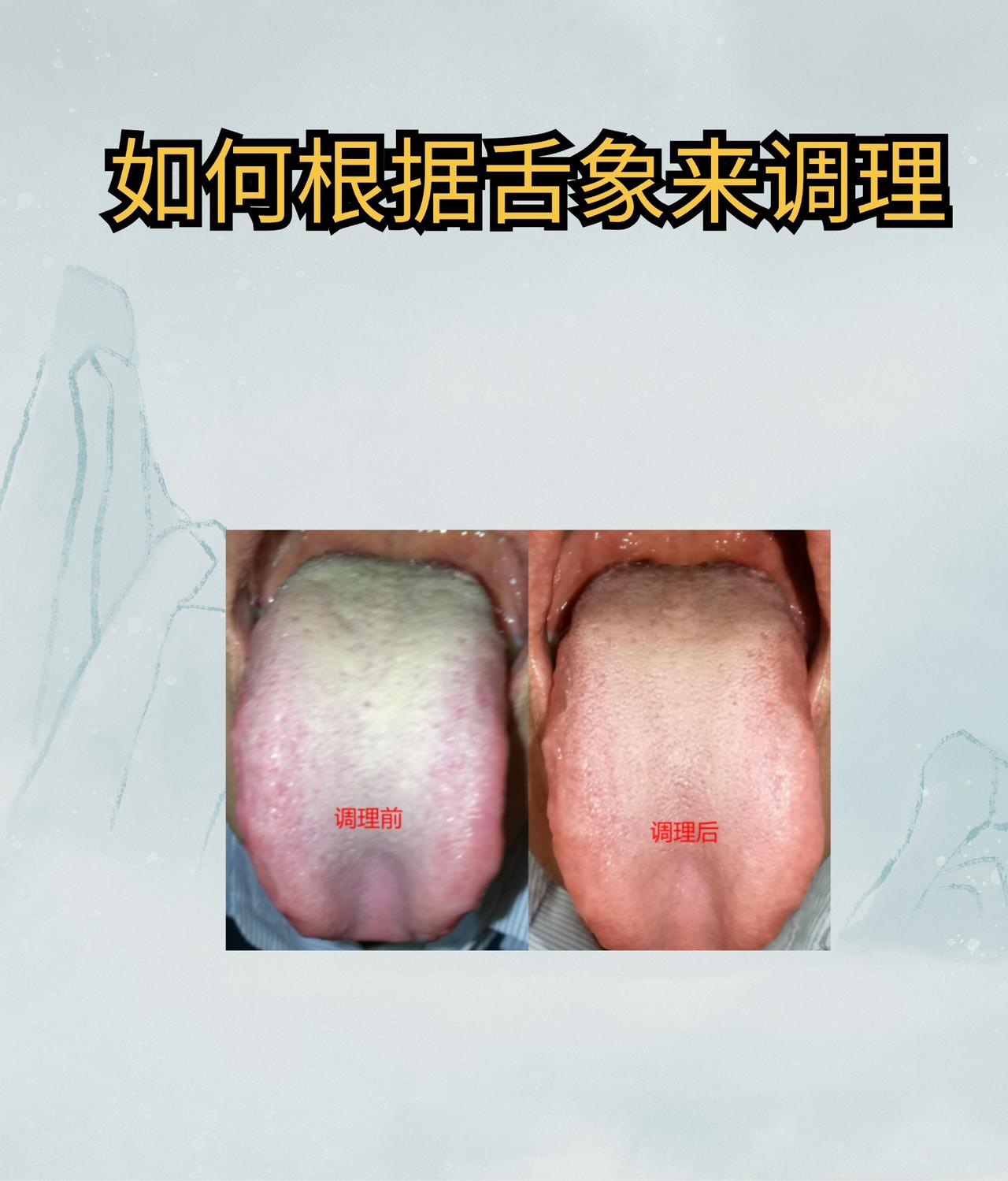 我只用1招，坚持十天，舌苔大变样，中医补肾健脾，疏肝祛湿思路教给你#中医##中医