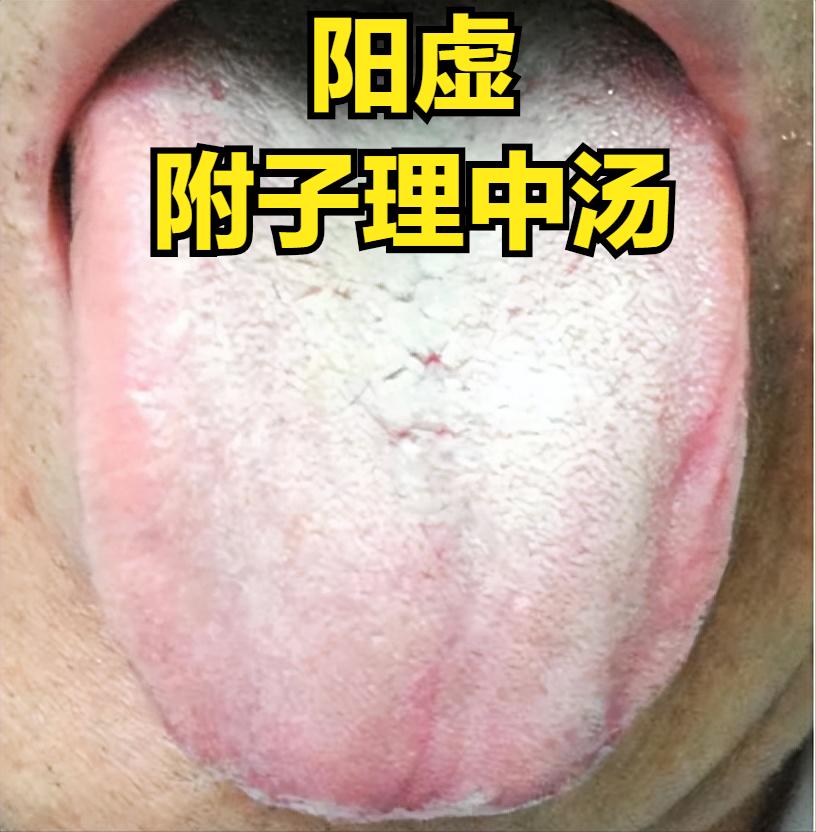 喜喝热水——阳虚，喜喝冷水——阴虚，不喜喝水——痰湿！
 
1. 喜欢喝热水——