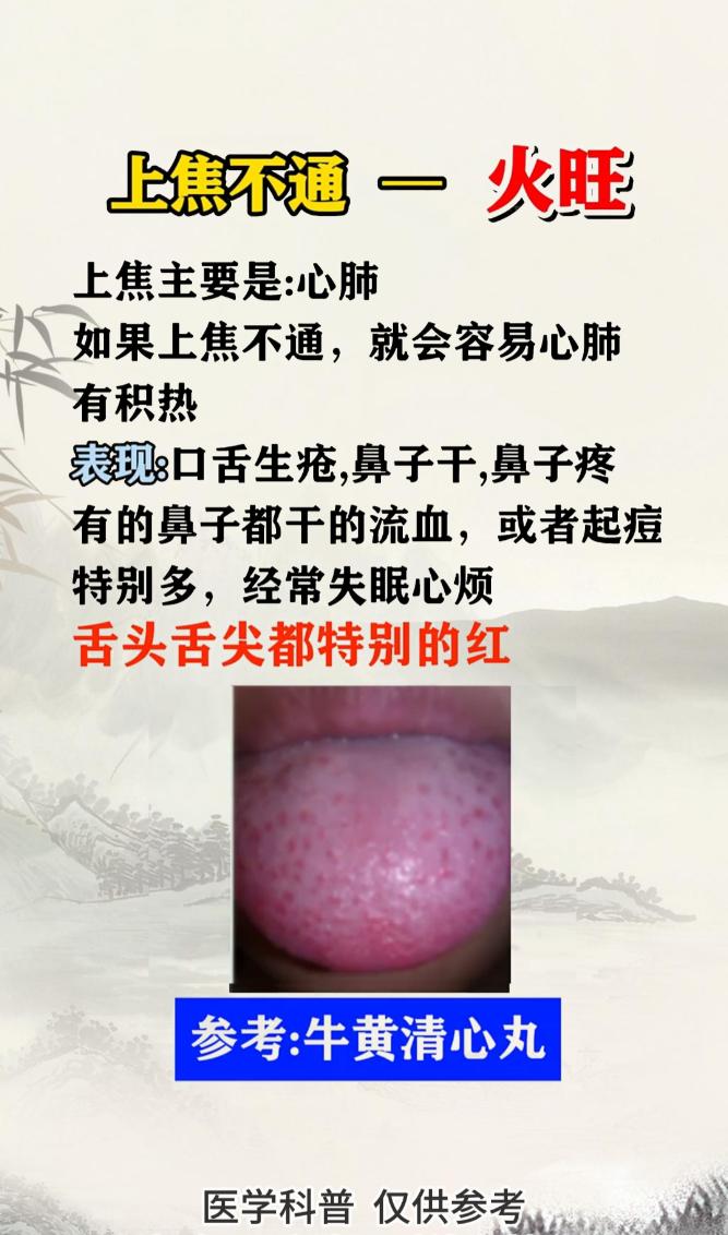 三焦一通，疾病全消，上焦不通火旺，中焦不通胃胀，下焦不通老的快，中医教你3盒中成