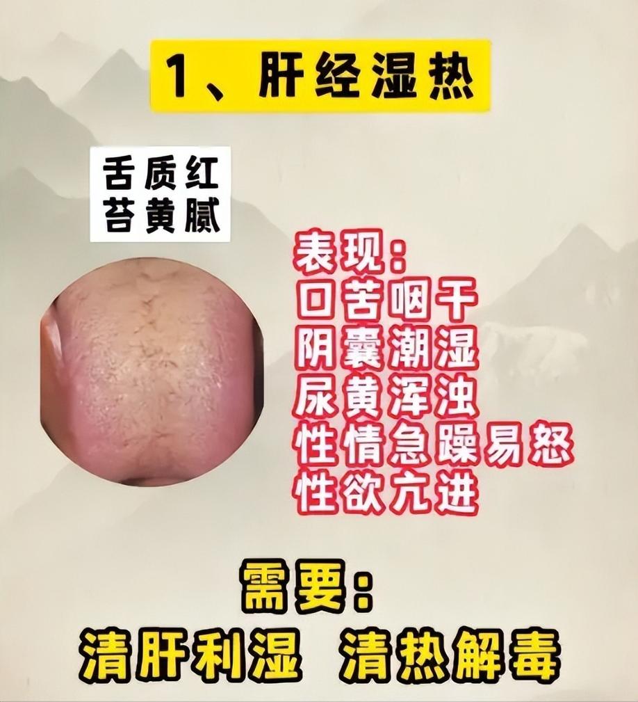 4 种常见体虚失固证型，中医辨证调理