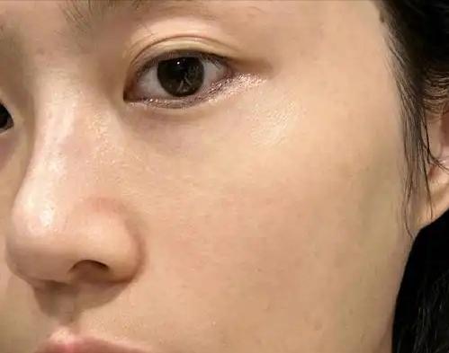 为什么脸早上洗完白净透亮，一到下午就暗沉发黄？其实不是真的黄，而是脸被氧化了。