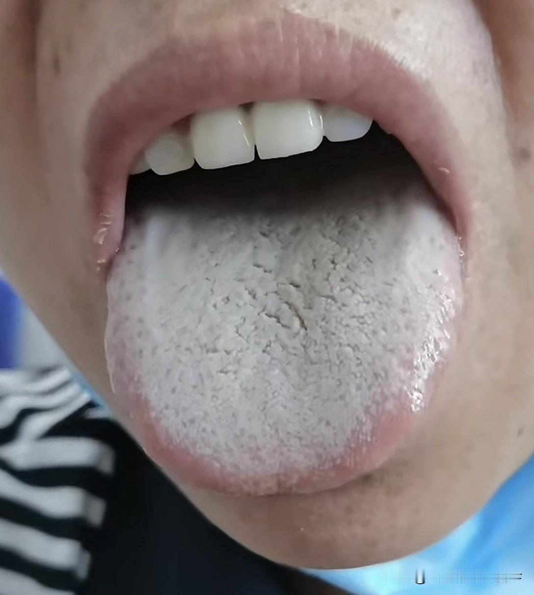 刚二十出头的小伙，舌头看着头皮发麻，一整个大无语！[汗]

又是阳虚，又是痰湿，