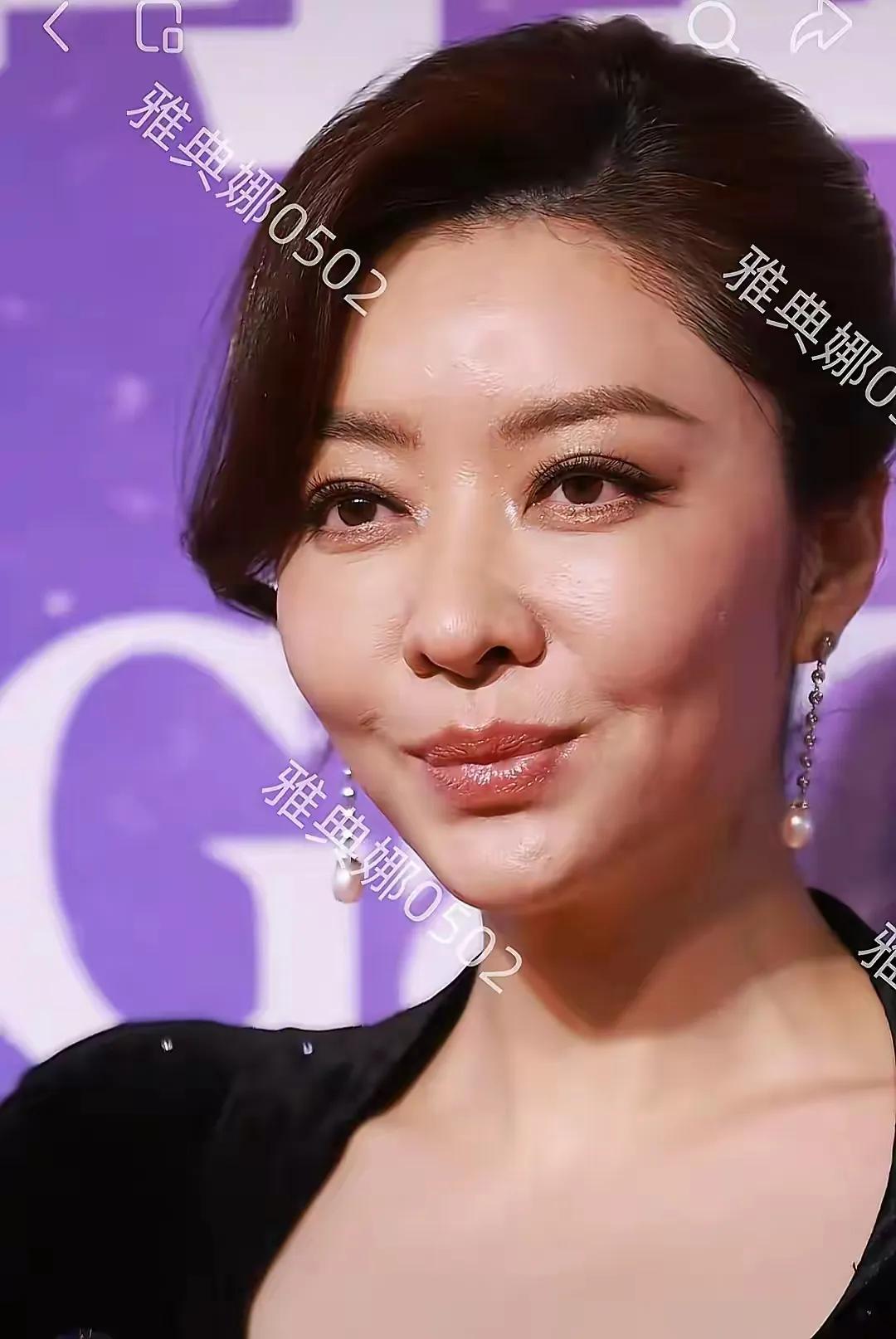 熊黛林的鼻子是蒜头鼻，五官不精致，她20年前的时候，长得非常漂亮，五官也很完美，