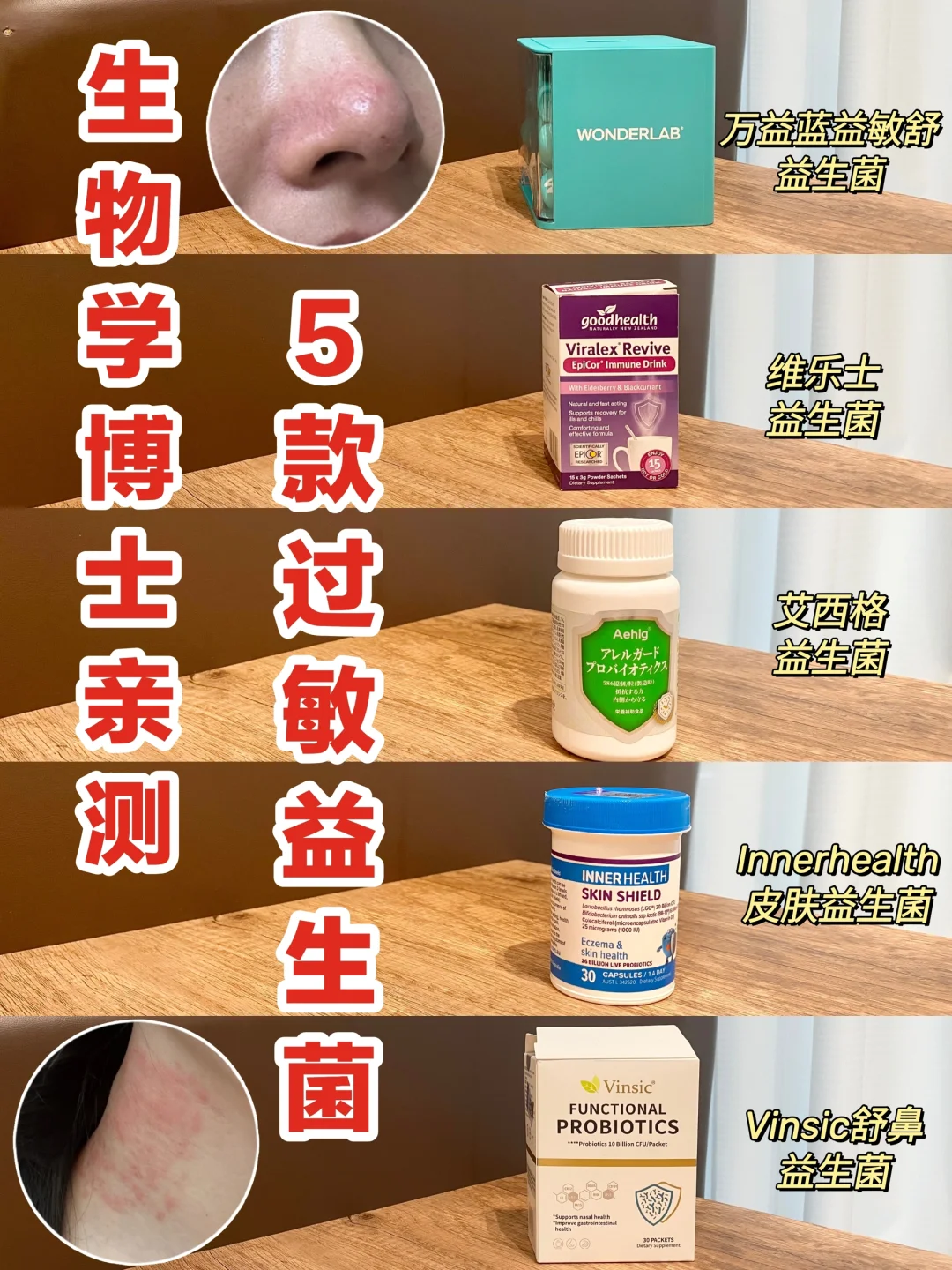 生物学博士亲测！过敏益生菌感受分享！