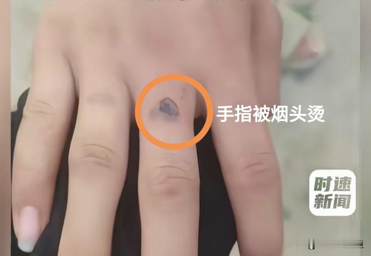 甘肃三名学生因拘禁持械抢劫14岁同学被判抢劫罪入狱」，家长申诉被驳回。

以极其