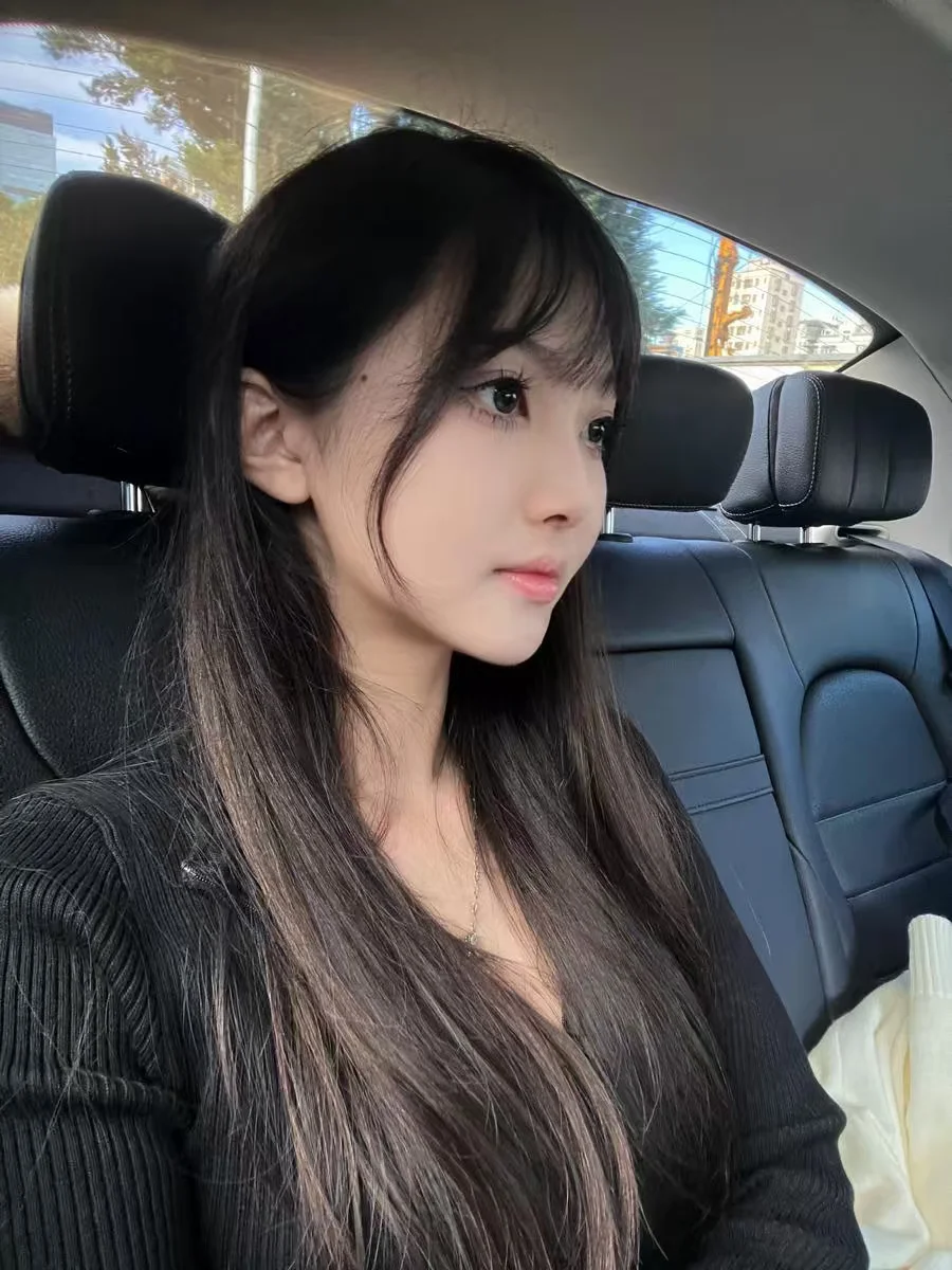 成年骨突矫正晚了吗？坐标深圳