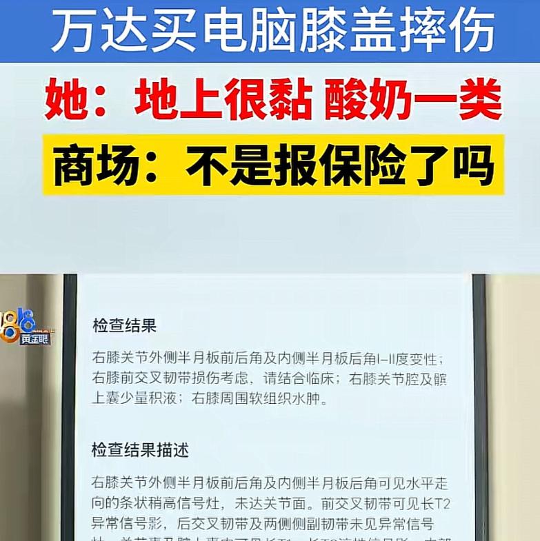 浙江杭州，一女子逛商场，意外摔倒，导致膝盖受伤，随后，女子发现地面洒有类似酸奶、