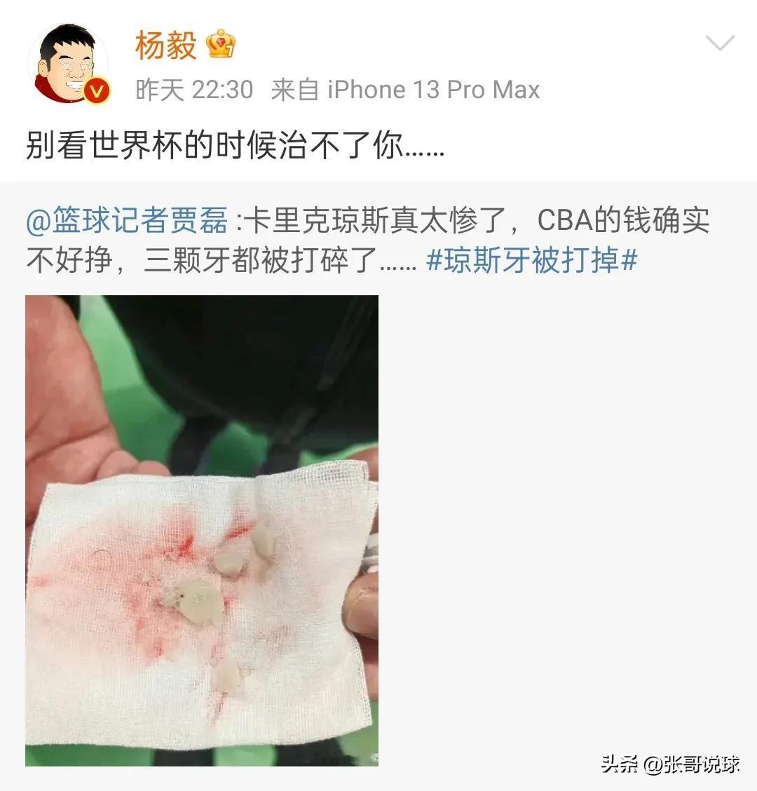 杨毅点评付豪肘击琼斯，别看世界杯的时候治不了你，后面是省略号，省略号的意思大概就