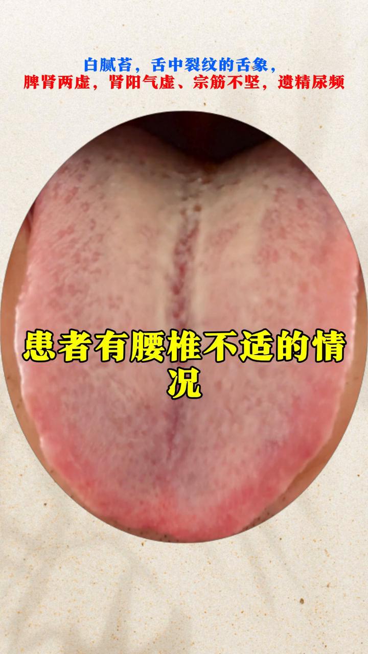 这种舌头凹陷裂纹深，厚腻苔，舌质淡白，舌边鼓胀，肝郁，脾肾两虚，肾阳气虚的问题。
