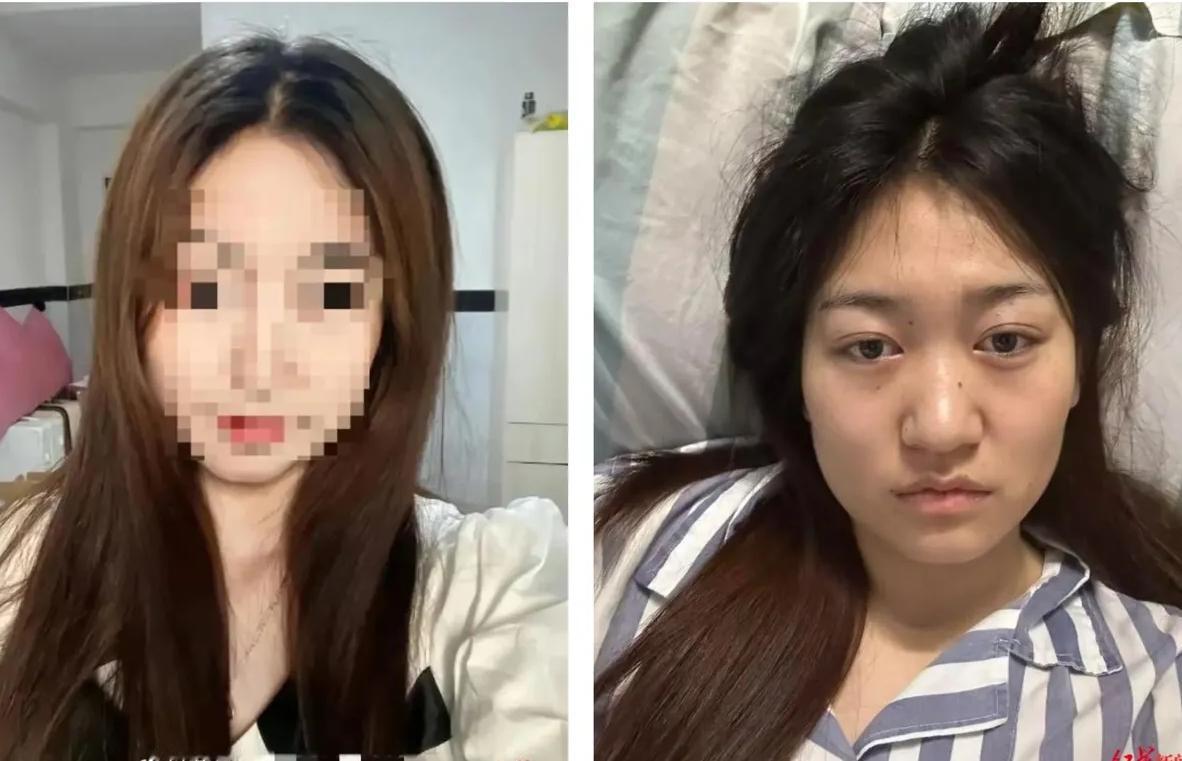 2岁女孩小徐的遭遇，真的让人破防！公厕被陌生男子暴打20分钟，牙齿嵌进肺部、全身