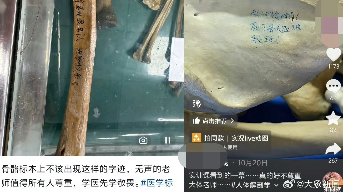 【有医学生在大体老师身上写画取乐】敬畏生命是医学的第一课 “你好可怜，死了骨头还