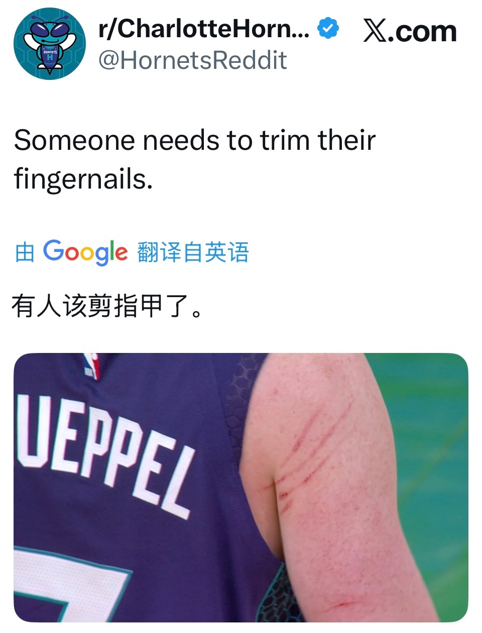 KK又上场了……但是对面有人是不是太不讲卫生了点？ 