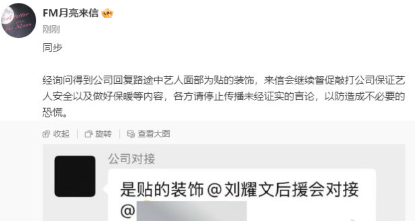 刘耀文脸上是贴的装饰刘耀文脸上没受伤 还好没受伤！ 