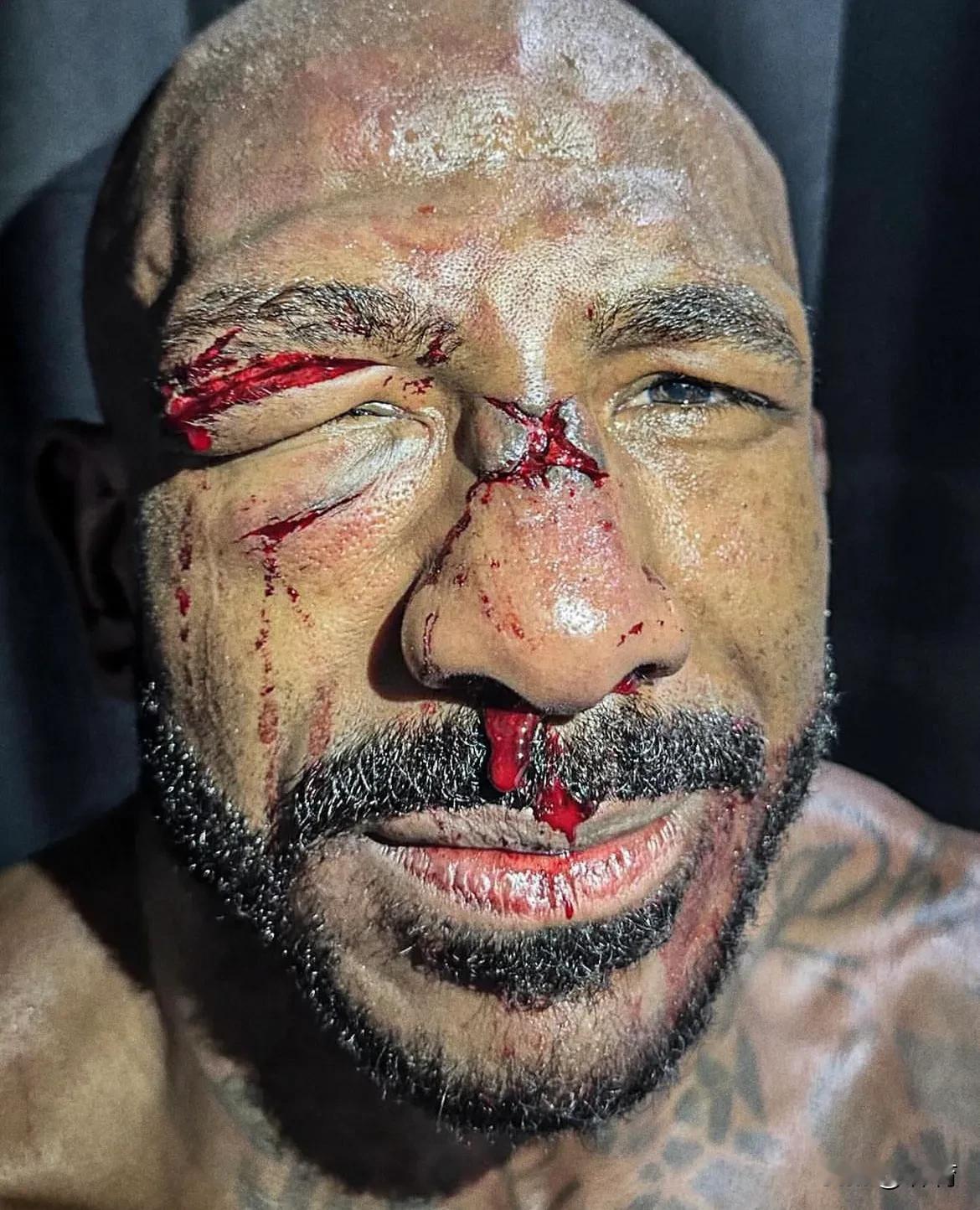 UFC真是勇敢者的游戏，冒着生命危险去赚钱也是值得敬佩！大拿可以考虑提升花红了。