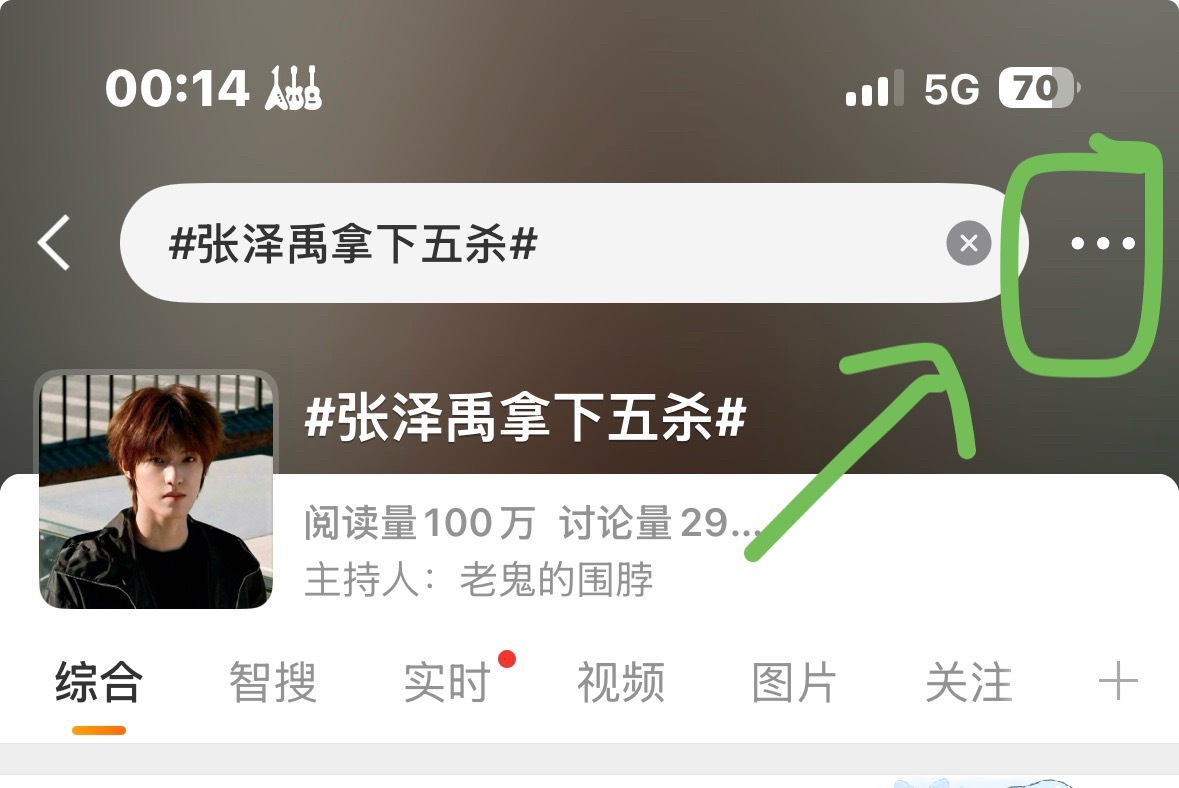 张泽禹拿下五杀宝宝们 来点ct右上角进行站外分享 分享进wx 