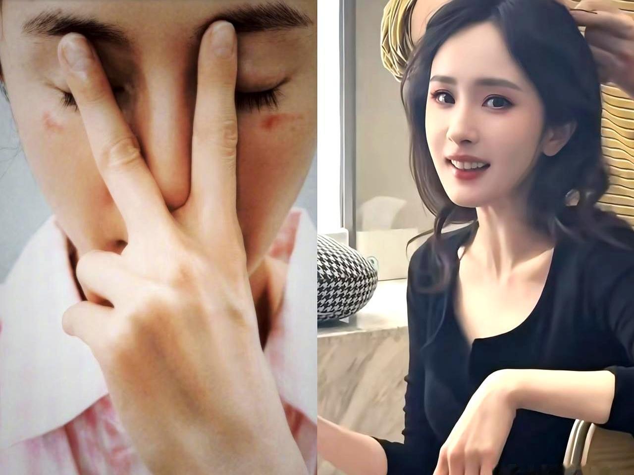 有钱美貌都见怪不怪了，刷到杨幂蒸汽眼罩“烫伤”那张图时，最扎眼的居然是她的手。