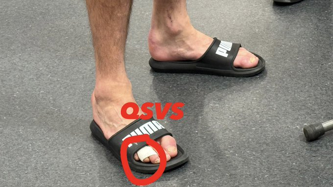 菲尔克鲁格的脚趾还是包扎着的…太硬了！AC米兰