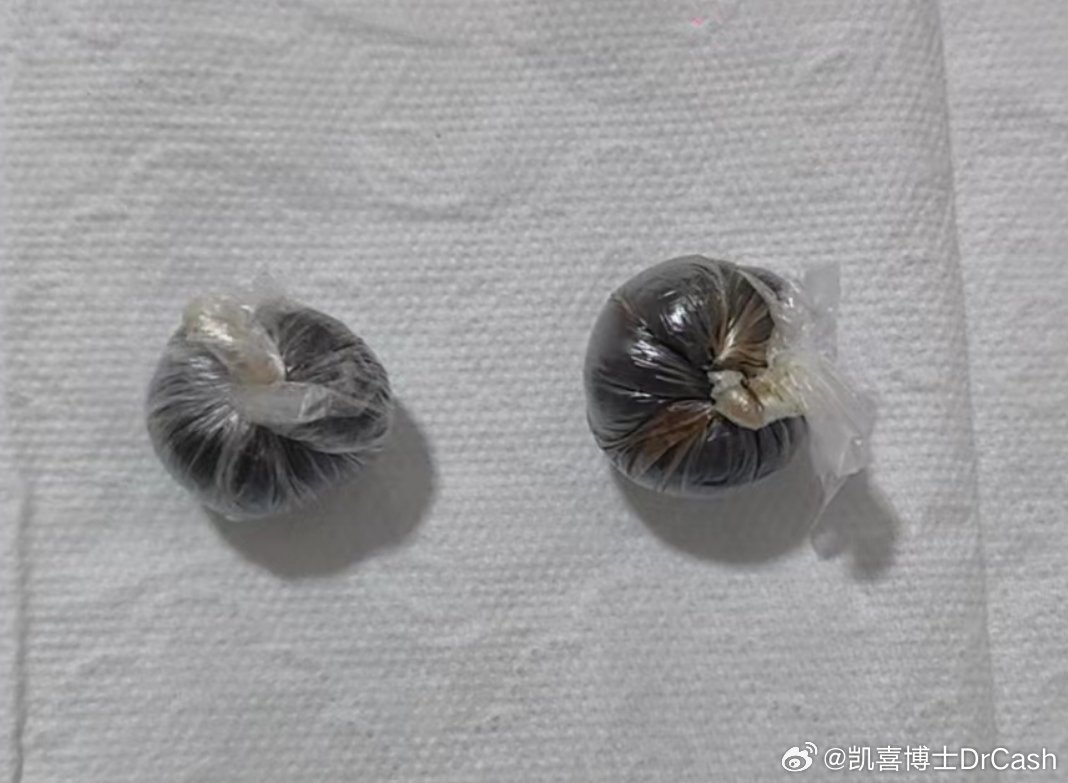 民间老中医做的药丸子，治疗一切关节痛。老中医去世了，后代接班。测出来的化学药物成