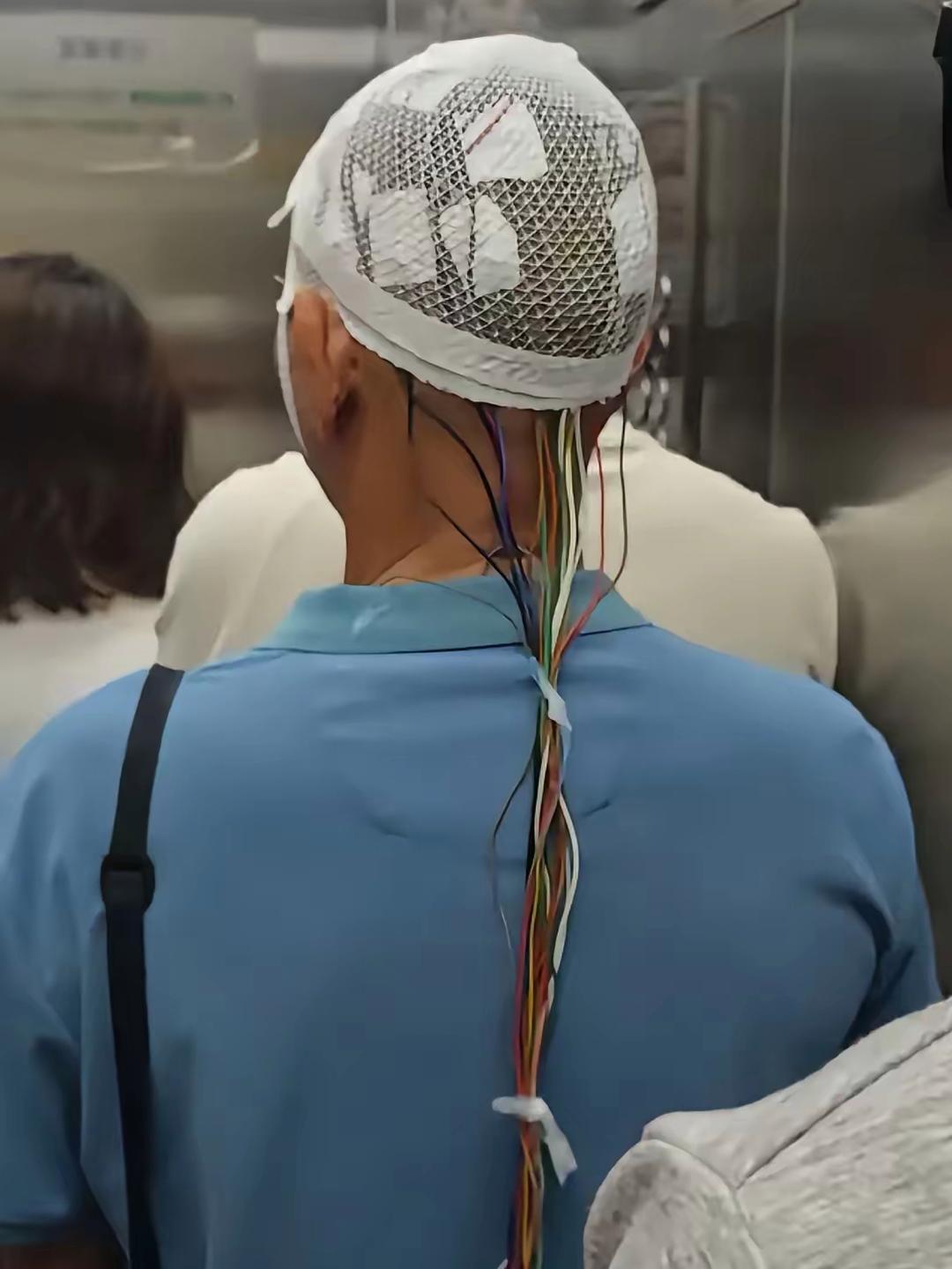 电梯里看见的，不懂就问，他这是戴的什么？
