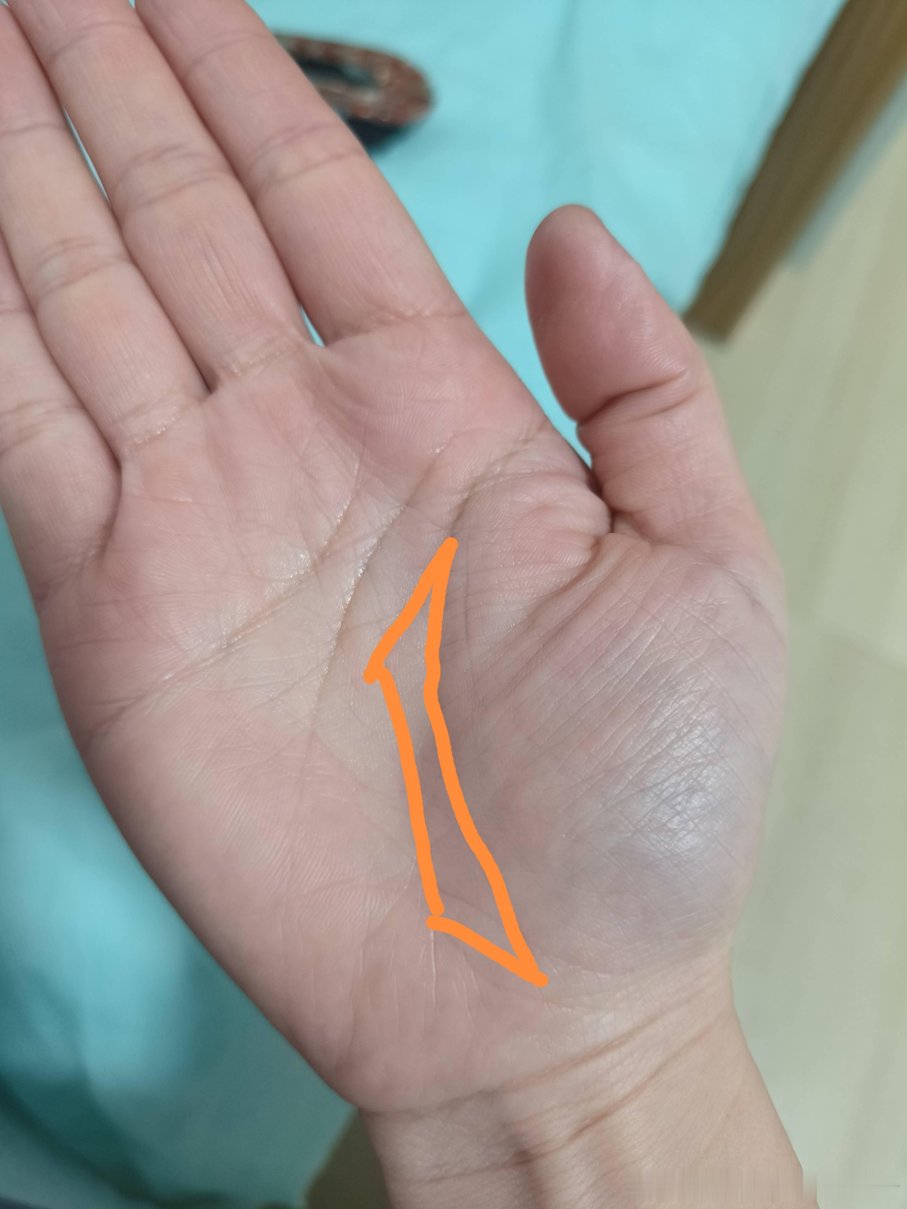 元宝纹，两边封口得好，没封好口的元宝纹没多大作用。代表的是有财运，但具体多大财还