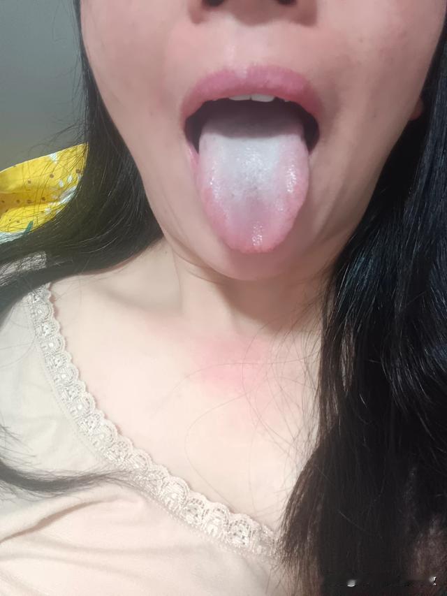每次来例假都疼的要命，平时手脚压根暖不热[流泪][流泪][流泪]
女性体质本就偏