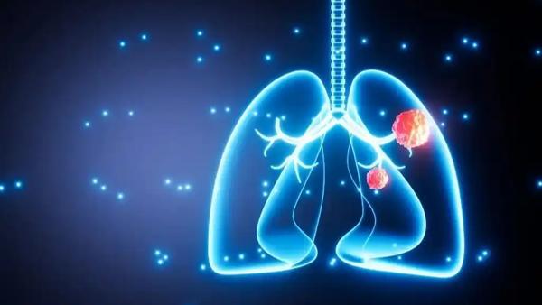 女性肺癌发病率的上升，为大众健康认知敲醒了警钟，也打破了“吸烟才会得肺癌”的刻板
