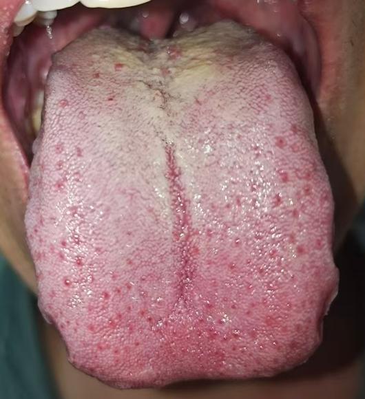 中途力不从心？别盲目进补，关键是这两个环节失调






对于男同志而言，最让