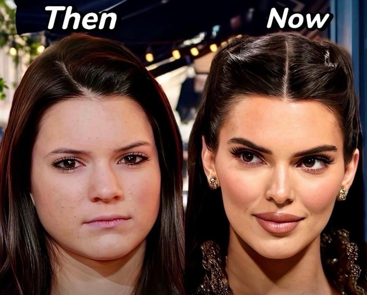 卡戴珊的妹妹 Kendall 居然整了那么多！