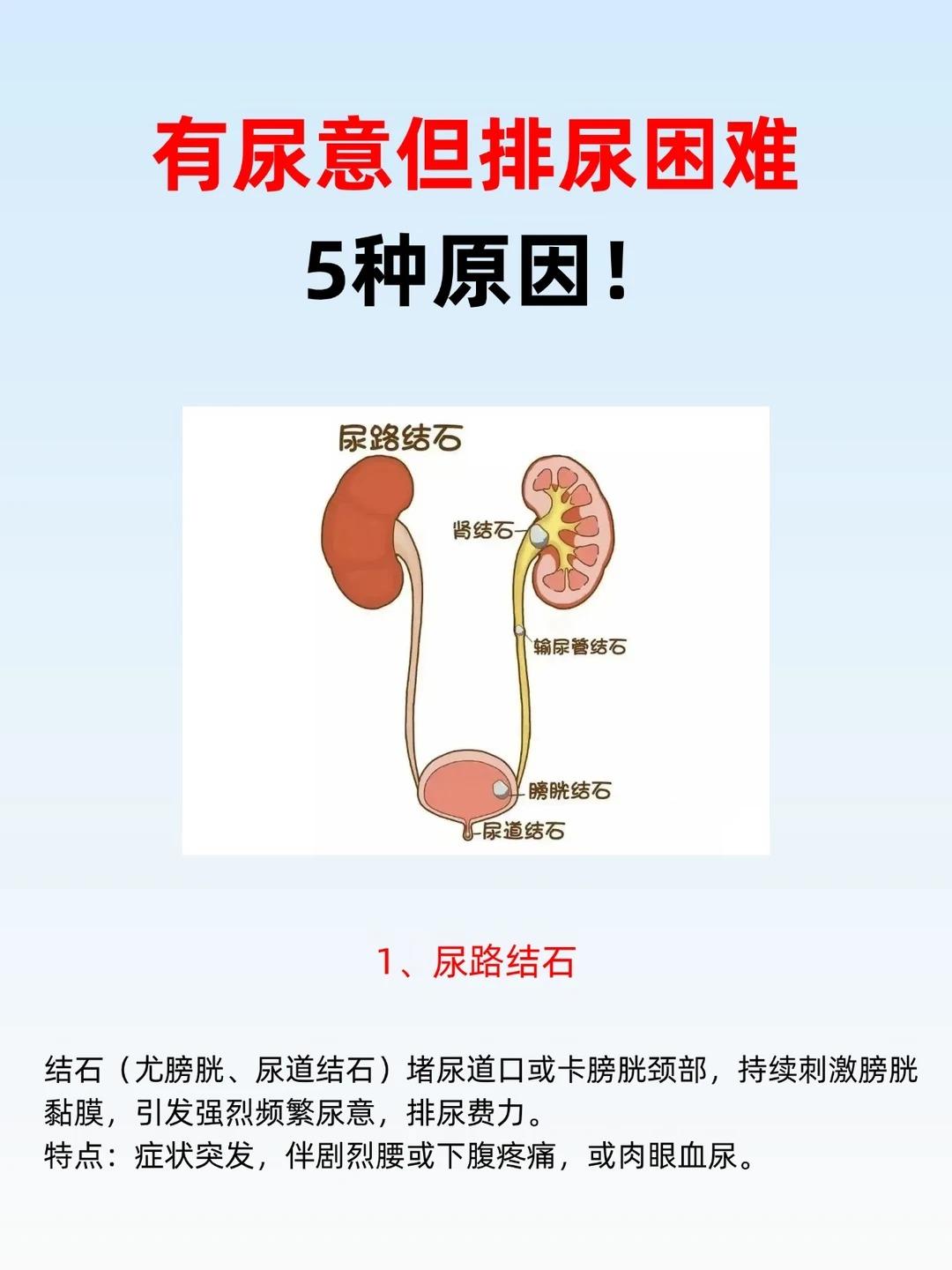 经常排尿困难？梳理 5 个不可忽视的诱因